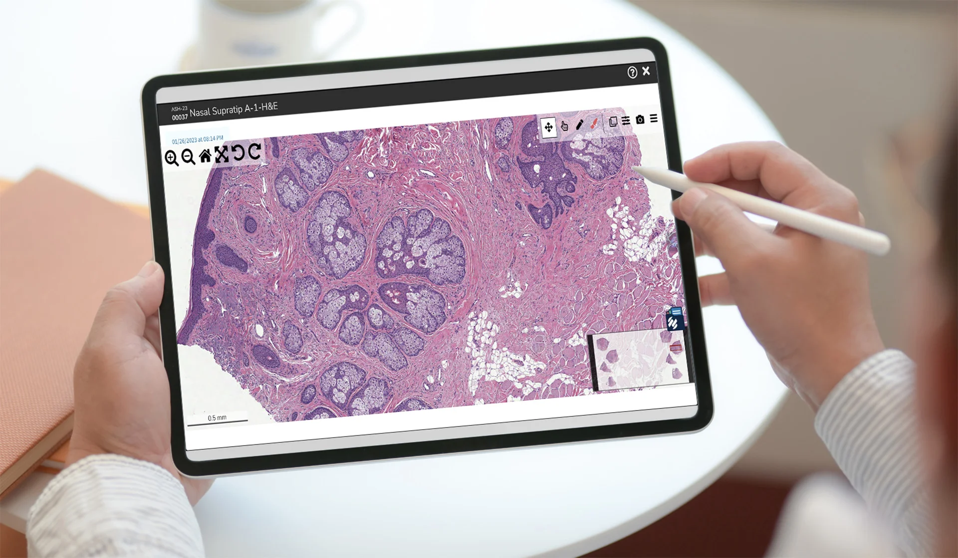 Digital Dermatologist Read out a case on an iPad